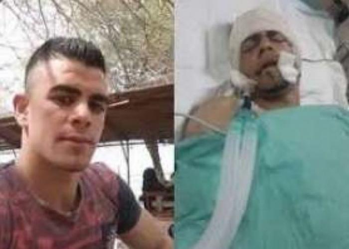 الاحتلال يسلم جثمان الشهيد جمال دويكات