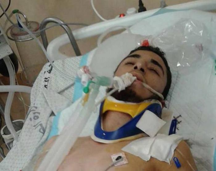 شهيد من غزة متأثرًا بإصابته برصاص الاحتلال قبل شهرين