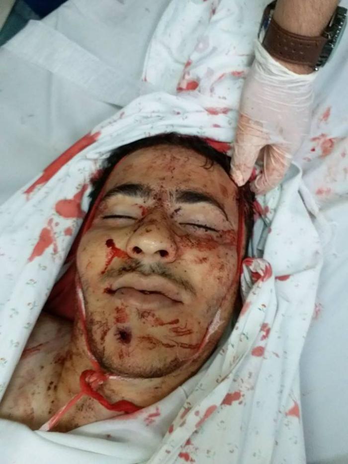3 شهداء و350 إصابة بالرصاص الحي والاختناق على حدود الشرقية لقطاع غزة