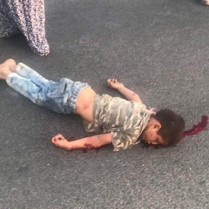 استشهاد طفل بعد دهسه من قبل مستوطن غرب الخليل