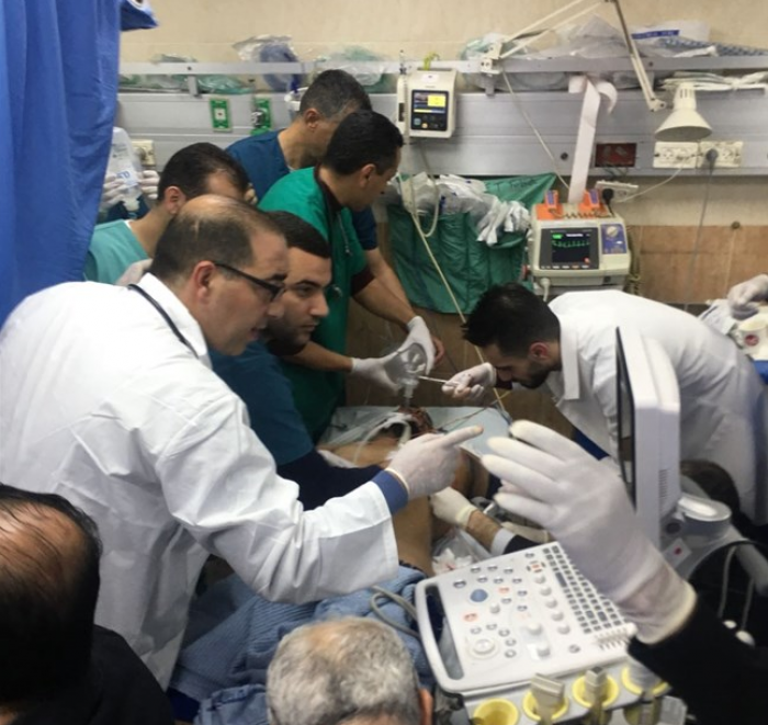 إصابة خطيرة خلال قمع أهالي قصرة للمستوطنين 