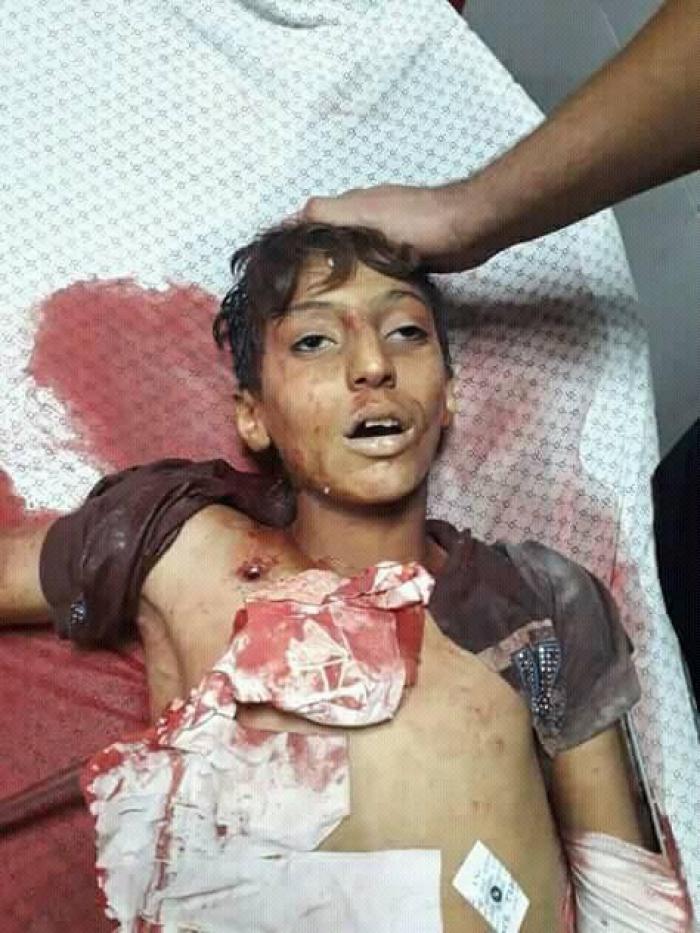 في جمعة الثبات والصمود شهيدان و 124 اصابة برصاص الاحتلال شرق قطاع غزة