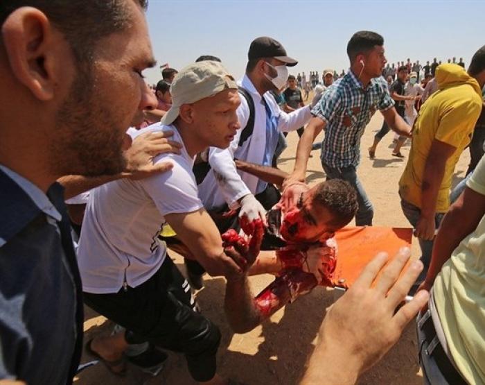 إصابة المئات من المواطنين بالرصاص والاختناق على حدود قطاع غزة الشرقية
