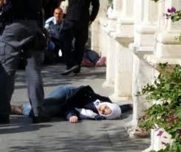  إصابة طفلة بذريعة محاولة الطعن