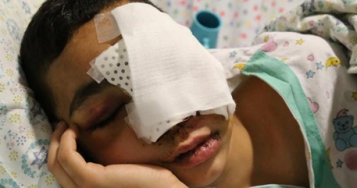 12 مواطنا مقدسيا فقدوا بصرهم بسبب استخدام شرطة العدو الرصاص الإسفنجي الأسود