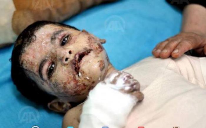 العالمية للدفاع عن الأطفال: استشهاد 550 طفلا في 2014