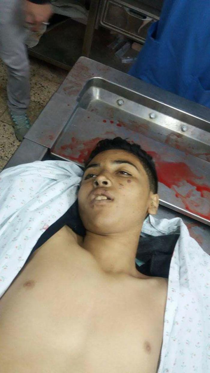 بالصور  8شهداء وإصابة  1070 برصاص الاحتلال فى جمعة الكوتشوك