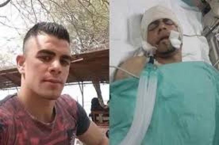 استشهاد الشاب جمال دويكات متأثر بجراحه