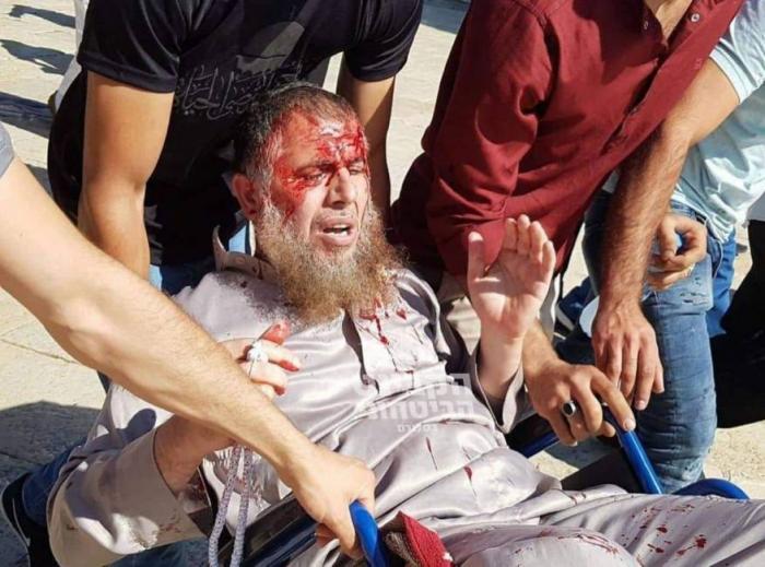 إصابة عشرات المصلين في مواجهات عنيفة في المسجد الأقصى 