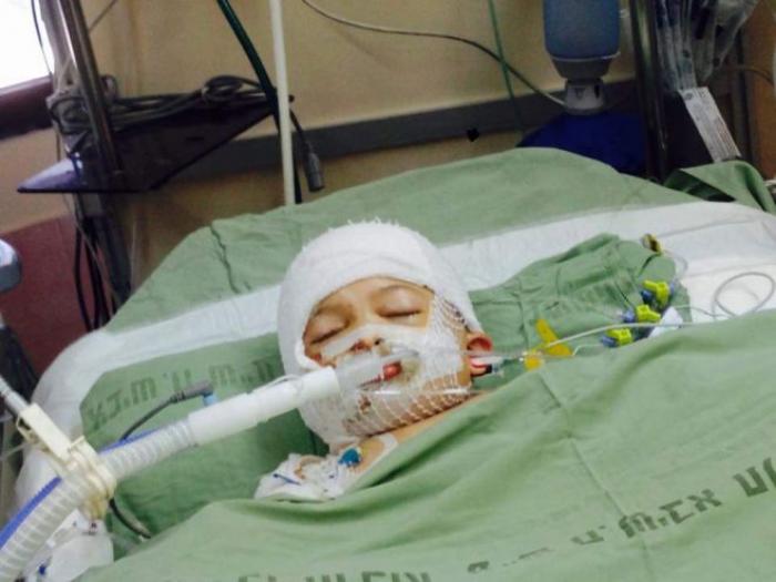 مصدر فلسطيني: حالة عائلة الدوابشة حرجة للغاية وشبه متوفيين من الناحية الصحية  